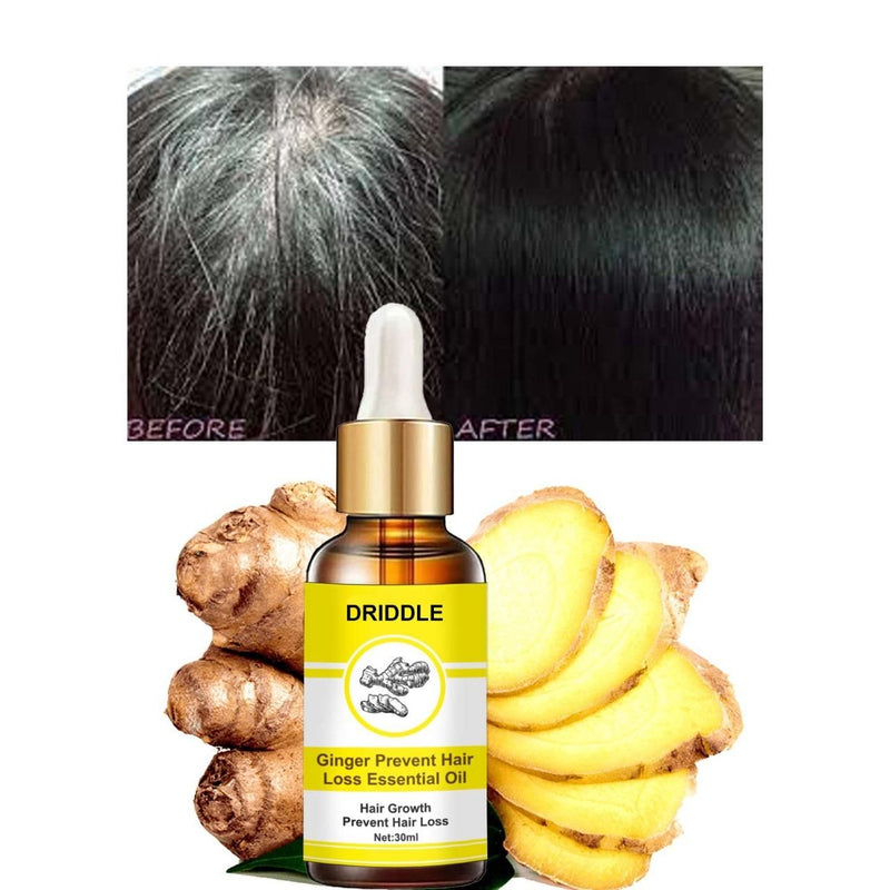 Ginger Prevent Hair Loss Essential Oil - The Trend Hype Store