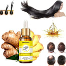 Ginger Prevent Hair Loss Essential Oil - The Trend Hype Store