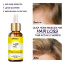 Ginger Prevent Hair Loss Essential Oil - The Trend Hype Store