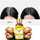 Ginger Prevent Hair Loss Essential Oil - The Trend Hype Store