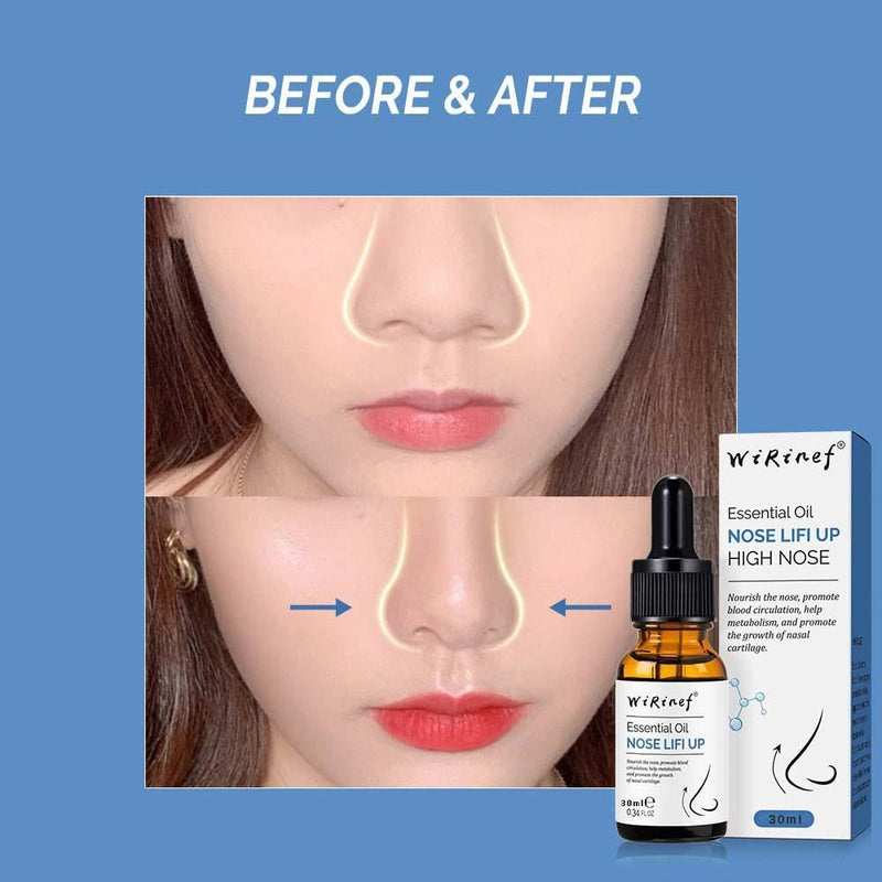 Lifting Essential Oil for Nose Shape - The Trend Hype Store