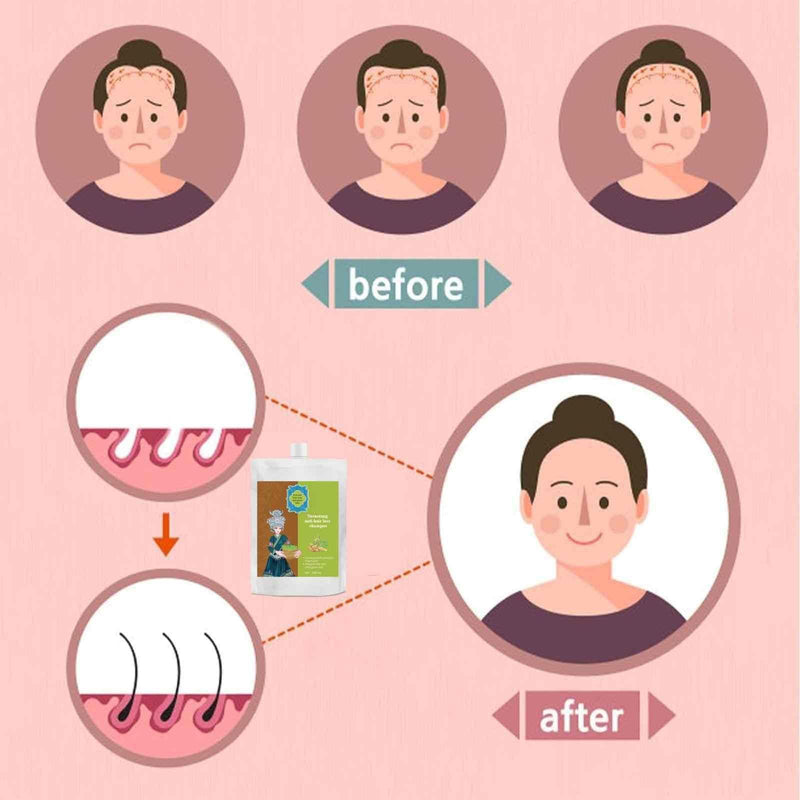 Anti-Hair Loss Hair Shampoo (Pack of 3) - Unlock the Secret to Healthier, Fuller Hair! - The Trend Hype Store