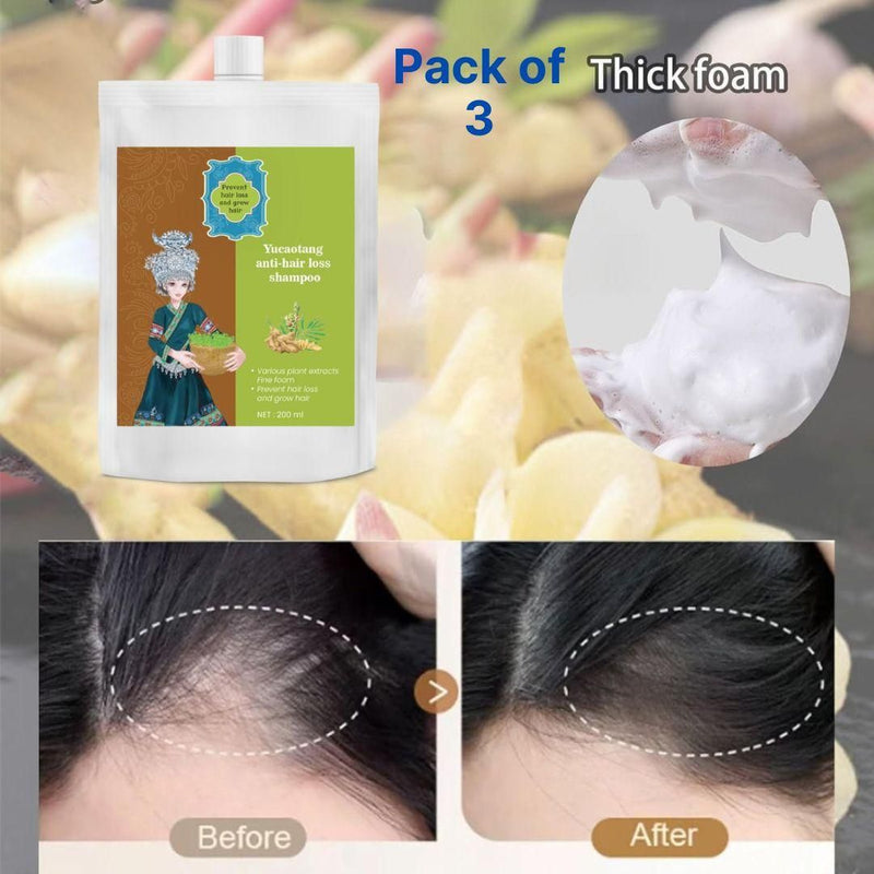 Anti-Hair Loss Hair Shampoo (Pack of 3) - Unlock the Secret to Healthier, Fuller Hair! - The Trend Hype Store